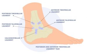 Ankle ligament anatomy